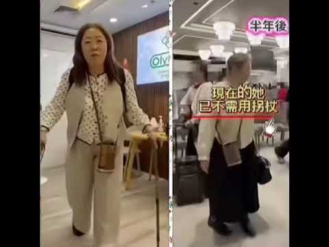 中風骨頭修復見證